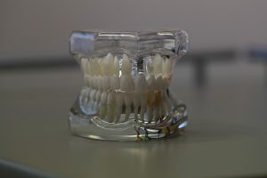 Oferta implanturi dentare